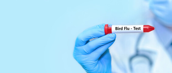 Doctor holding a test blood sample tube with Bird Flu test.Banner. Copy space for text