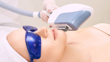 Laser unwanted hair cosmetology procedure. Beautiful young girl. Blue glasses. Face treatment. IPL...