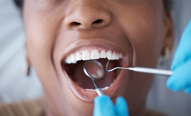 Checkup, teeth and woman with a dentist for oral hygiene, cavity check or cleaning mouth. Zoom,...