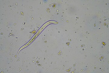 insect parasite in the soil in australia under the microscope