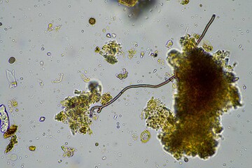 soil fungi, microorganisms and nematodes in a soil and compost sample.