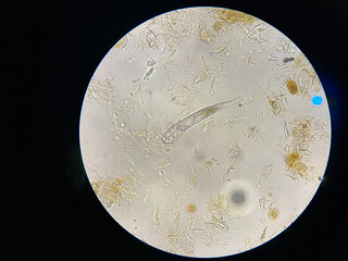 Demodex mange from a microscope view.