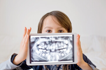 Child, preteen boy, holding tablet with a picture of his x-ray teeth - obrazy, fototapety, plakaty
