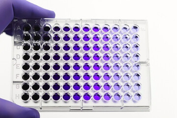 Hand with glove picking up a lab plate with clinical or research samples