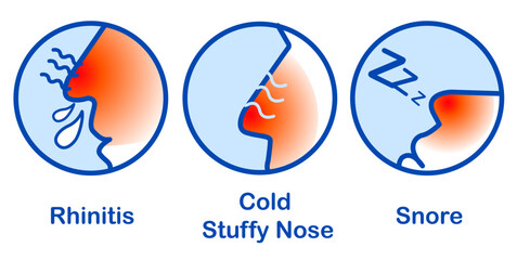 Rhinitis Cold Stuffy Nose Snore, Runny nose icon isolated . Rhinitis symptoms, treatment. Nose and sneezing. Nasal diseases. Vector Illustration - obrazy, fototapety, plakaty