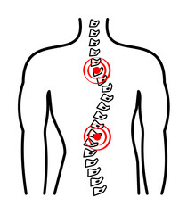 scoliosis, spine, pain icon illustration design art