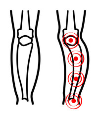 paget's disease, pain icon illustration design art
