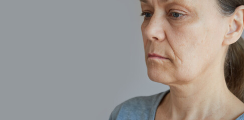 Profile of the face of a mature woman with a swelling on her cheek, with a toothache. Copy space image