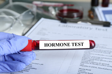 Obraz premium Doctor holding glass tube with blood sample and label Hormone Test at table, closeup