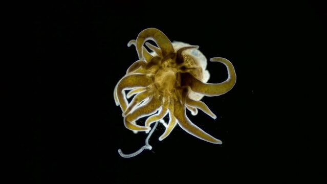 Young Actiniaria under a microscope, class Anthozoa, Hexacorallia, about 5 mm in size. Specimen was found in Red Sea. Tentacle movement. Sea Hydra