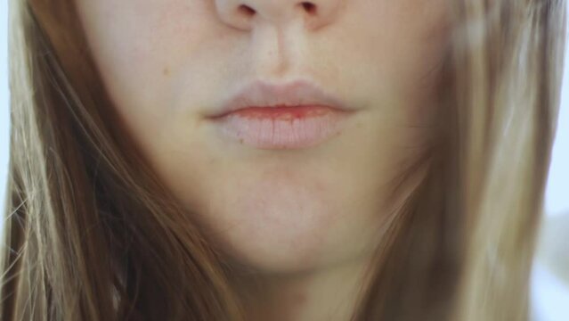 Close-up of dry chapped female lips. cracked lips