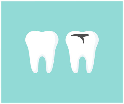 Shiny, healthy tooth and tooth with decay logo design. Concept dentistry, dental treatment, correction of occlusal, oral care, caries prevention vector design and illustration.