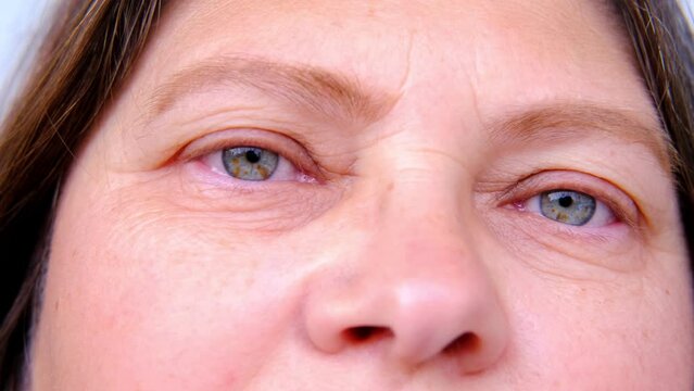 close up part of mature female face, woman 50-55 years old looks sad, deep wrinkles, age-related skin changes, wrinkles around eyes, concept of cosmetic anti-aging procedures, age crisis