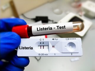 Test tube and rapid test cassette for Listeria bacteria test, diagnosis for Listeriosis