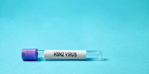 H3N2 virus text with virus test tube. Testing viral disease. Virus testing. H3N2 concept.