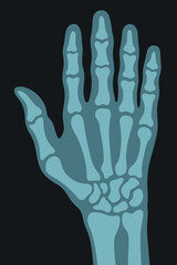 X ray right human hand ultra skeleton body bone roentgen front view vector flat illustration