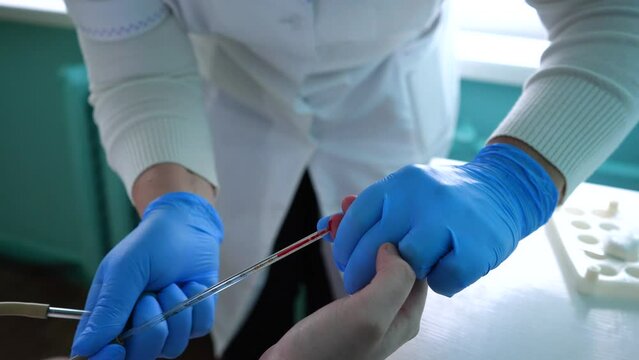 The doctor takes a blood sample from the patient's finger. Blood analysis. Close-up of blood from a finger. High quality 4k footage