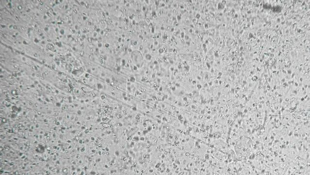 Study of a genetic sample. Reproductive function of man. Slow motion filming of the movement of active spermatozoa under a microscope. Sperm bank. The survival of all mankind
