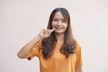 Asian woman pointing at mouth with braces