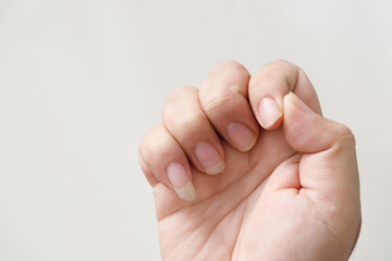 Problems with long, dirty fingernails and bacterial germs