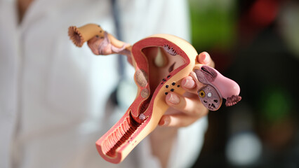 Model of female reproductive system in doctor's hand close up. - obrazy, fototapety, plakaty