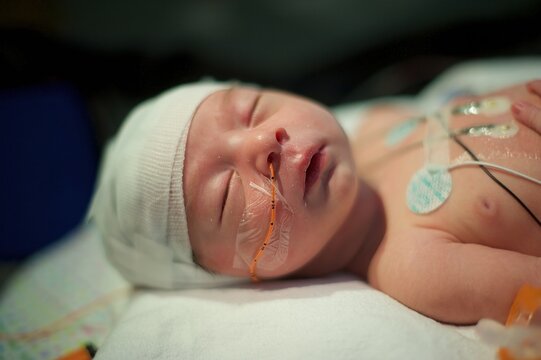 Sick Baby With Brain Injury Sleeping In NICU Bed With Oxygen Monitor And Head Bandages