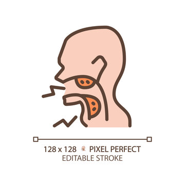 Tonsillitis cancer pixel perfect RGB color icon. Inflammatory process in throat. Viral infection caused disease. Thin line illustration. Contour symbol. Vector outline drawing. Editable stroke