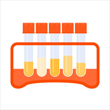 Urine sample rack with test tubes showing dehydration level. Yellow specimen liquid containers kit. Laboratory equipment. Medical concept. Vector illustration.