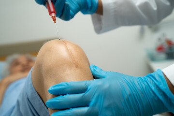 Asian doctor inject Hyaluronic acid platelet rich plasma into the knee of senior woman to walk...