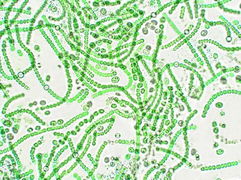 Nostoc sp. algae under microscopic view, cyanobacteria, blue-green algae
