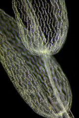 Microscopic view of peat moss (Sphagnum) detail. Darkfield illumination.