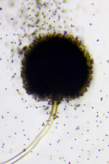 Microscopic view of a conidial head of Black mold (Aspergillus niger) with spores. Brightfield illumination.