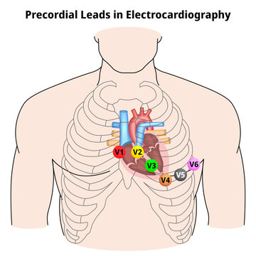 Precordial Leads in Electrocardiography - V1, V2, V3, V4, V5, and V6 - Position of ECG Chest Leads - Vector Medical Illustration