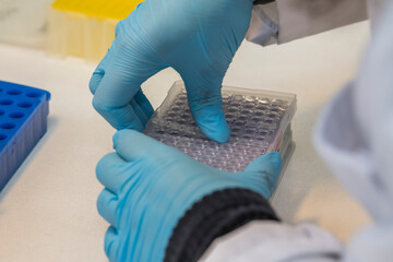 One hand holding  a plastic pcr plate and another hand closing the pcr plate with optical caps in a laboratory, wearing blue nitril gloves.