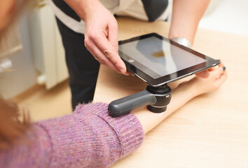 dermatologist examines moles on a female patient's arm with a dermatoscope and a computer tablet....