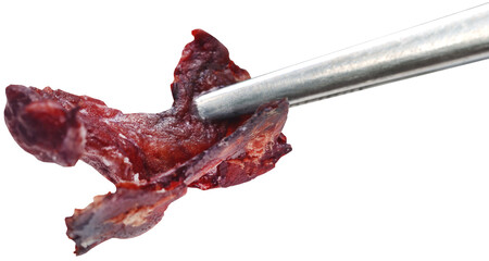 Thick blood tissue with forceps