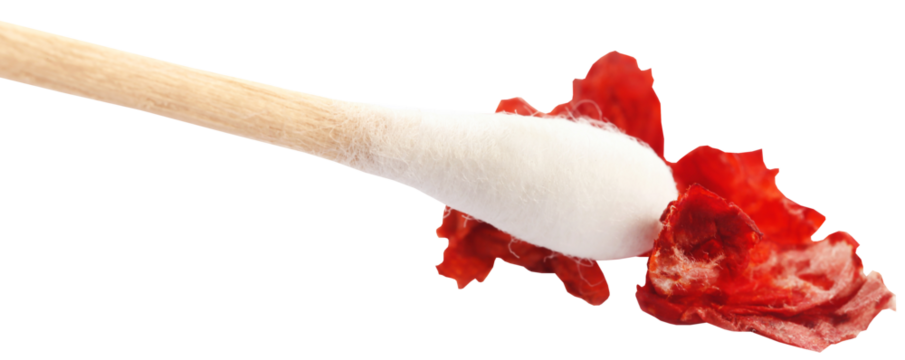 Blood in tissue paper