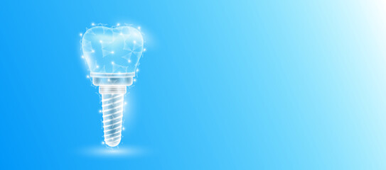 Dental implant form line triangles connecting on blue background. Futuristic glowing tooth hologram translucent white and copy space for text. Medical anatomical concept. Modern design vector. - obrazy, fototapety, plakaty