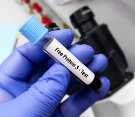 Blood sample for free protein S test to diagnosis of coagulation disorder. Pulmonary embolism....