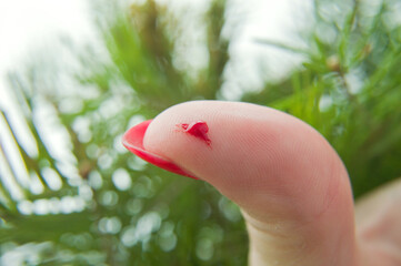 injured finger with a bleeding open wound on a background of green pine branches. Close-up of a...