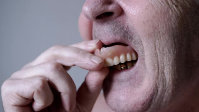 Close up, Smiling Elderly Male Pensioner with False Dentures and Golden Teeth. Old pensioner holds in hands removable dentures of upper jaw. Laughing wrinkled, unshaven face of a senior. Open mouth.