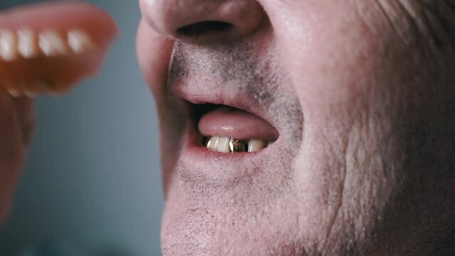 Smiling Old Elderly Man Takes Out an Upper Denture from Mouth and Fixes it Back. Laughing wrinkled, unshaven face of a senior with white dental implants, an artificial upper jaw, golden lower teeth.