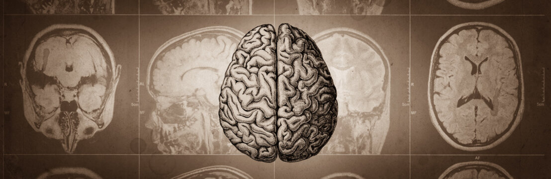 The human brain on the background of a computed tomography image. Medical and scientific background. Brain research.