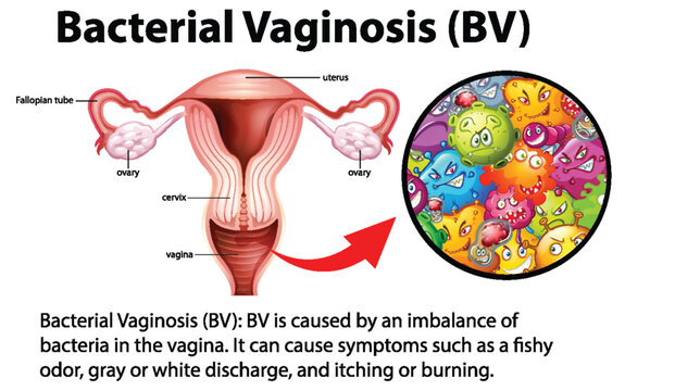 Vaginosis bilder – Bläddra bland 7,196 stockfoton, vektorer och videor