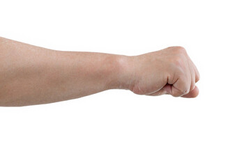 Painful wrist image.  Concepts of tunnel syndrome, arthritis, and neurological disorders. Paralysis