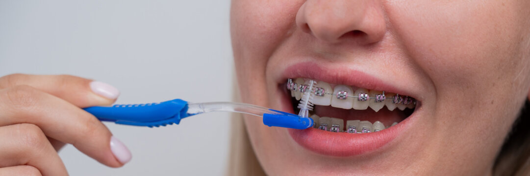 Caucasian woman cleaning her teeth with braces using a brush. Widescreen. 