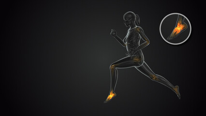 Obraz premium Woman with foot joint pain medical concept