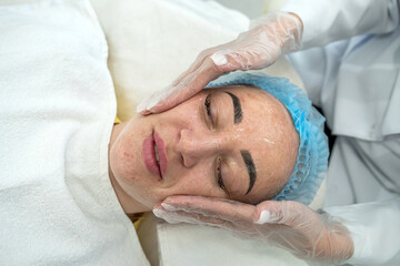 Fototapeta na wymiar applies a hydrogel mask to a young woman's face before laser treatment in a beauty salon.