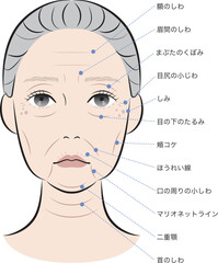 老化が進んだ女性の顔