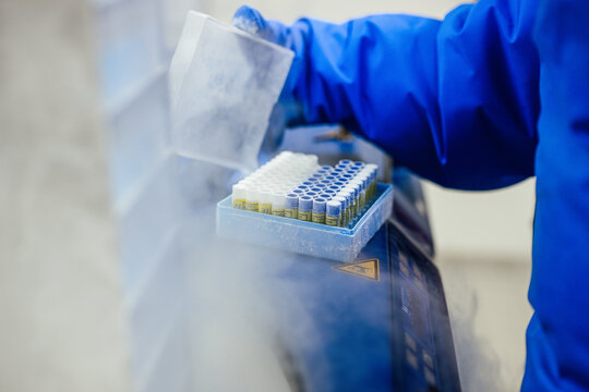 Laborkulturen im Trockeneis